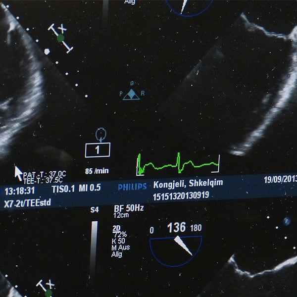 Radiography screens with text